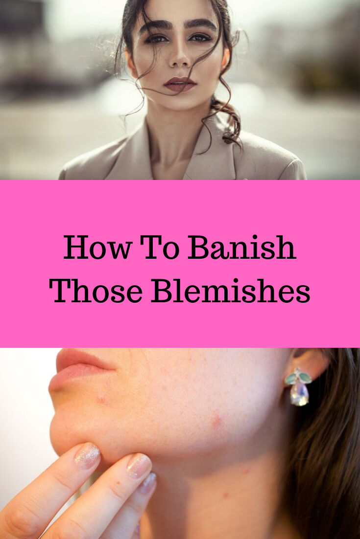 blemishes